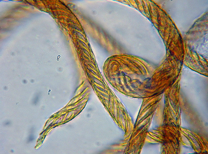 Trichia + Licea?